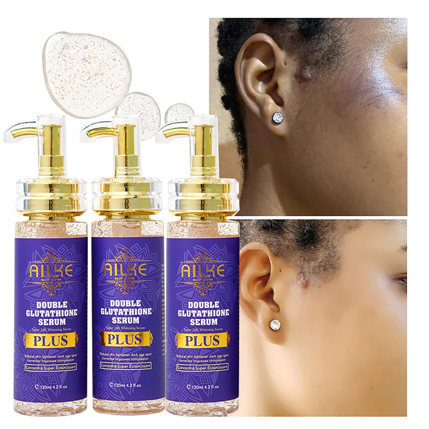 Glutathione Bleaching Cream for Radiant Skin and Dark Spot Removal
